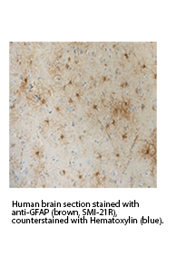 Human brain section stained with anti-GFAP (brown, SMI-21R), counterstained with Hematoxylin (blue).